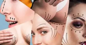 Os 10 pilares para reduzir litígios na Cirurgia Plástica