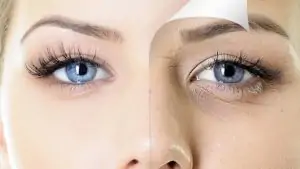 Cirurgia de blefaroplastia: Justiça de BH afasta responsabilidade de hospital